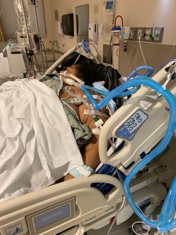 Romea lays in her hospital bed, hooked up to a ventilator which is assisting her to breathe.